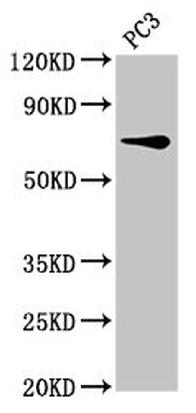 SCNN1B Antibody in Western Blot (WB)