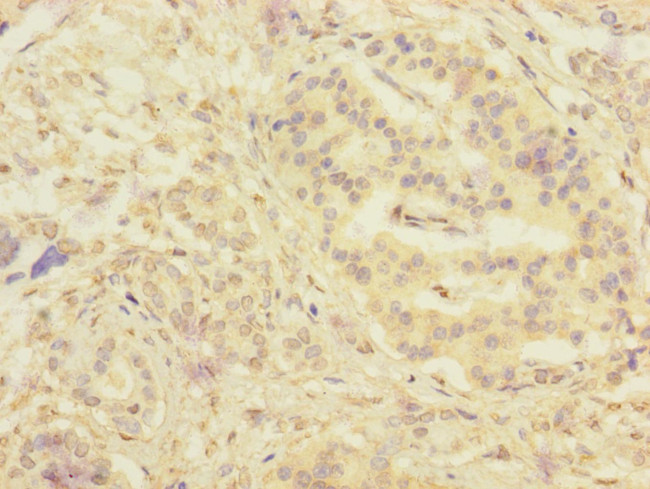 SERPINB6 Antibody in Immunohistochemistry (Paraffin) (IHC (P))