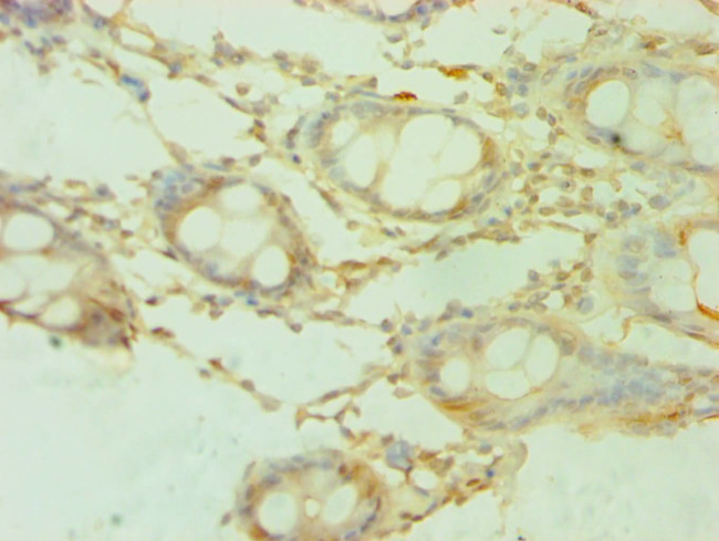 SHMT1 Antibody in Immunohistochemistry (Paraffin) (IHC (P))