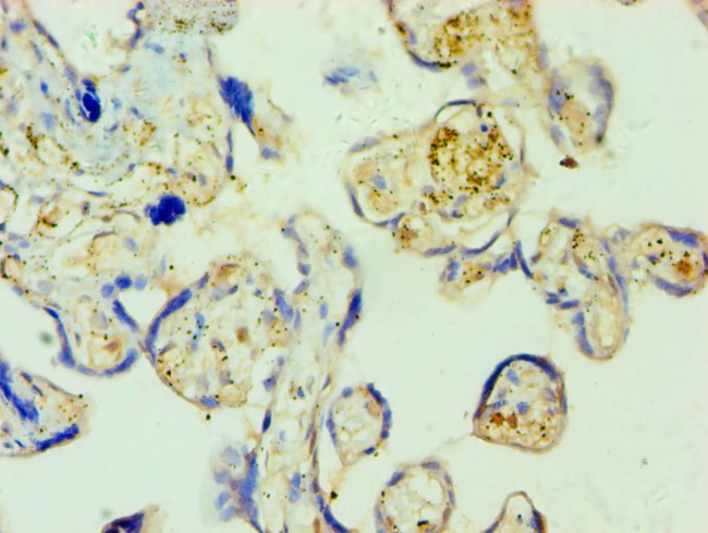 SHMT1 Antibody in Immunohistochemistry (Paraffin) (IHC (P))