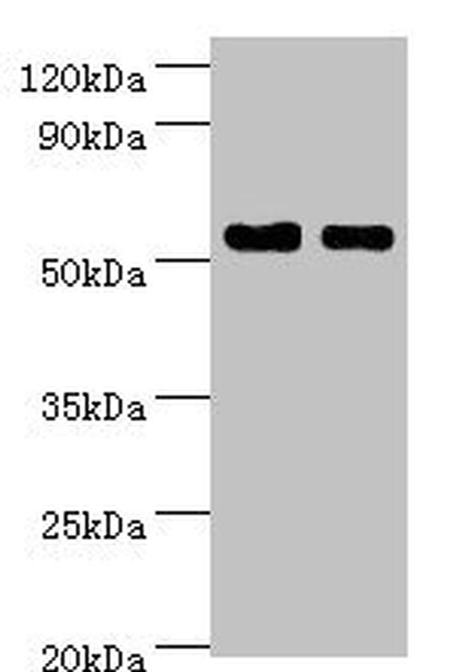 SHMT1 Antibody in Western Blot (WB)