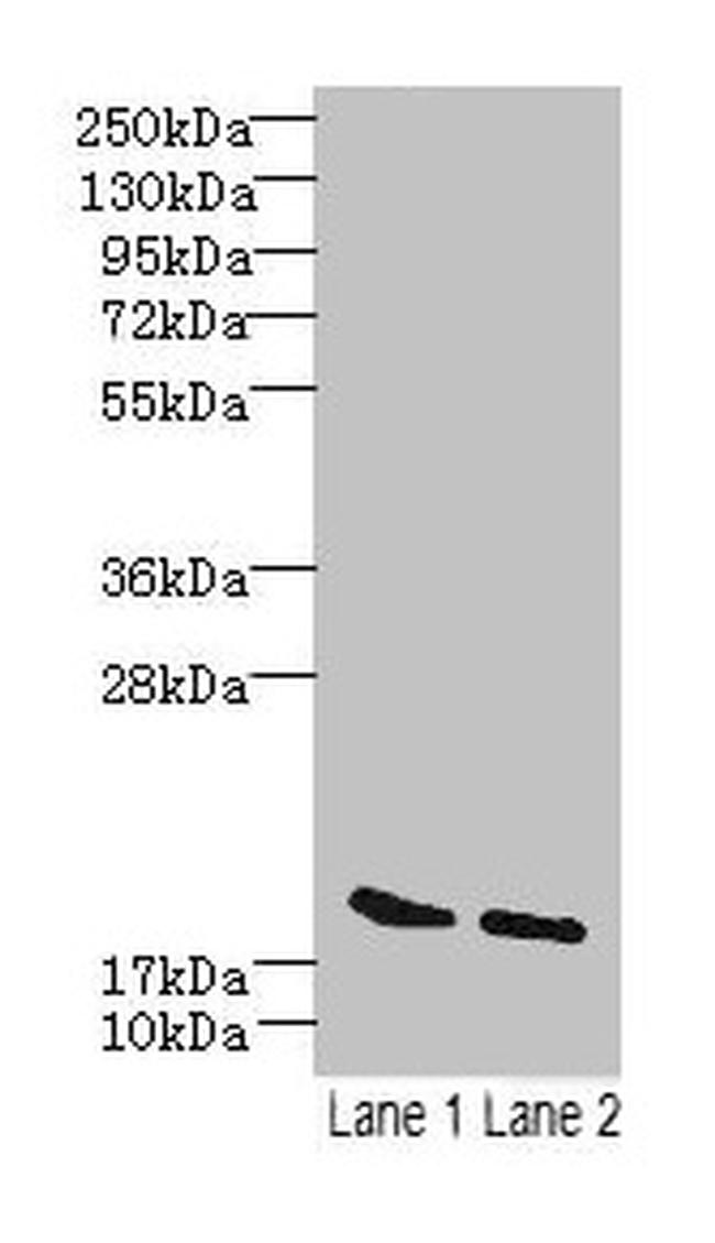 SKP1 Antibody in Western Blot (WB)