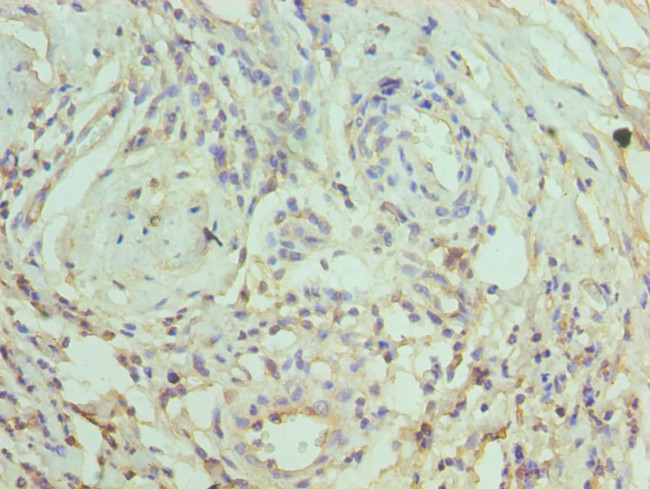 CRACC Antibody in Immunohistochemistry (Paraffin) (IHC (P))