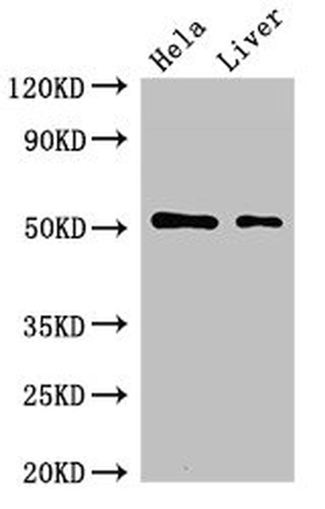 P3 Antibody in Western Blot (WB)