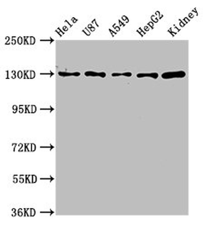 NKCC1 Antibody in Western Blot (WB)