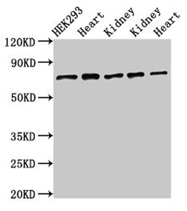 SLC25A12 Antibody in Western Blot (WB)