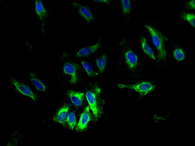 TAUT Antibody in Immunocytochemistry (ICC/IF)