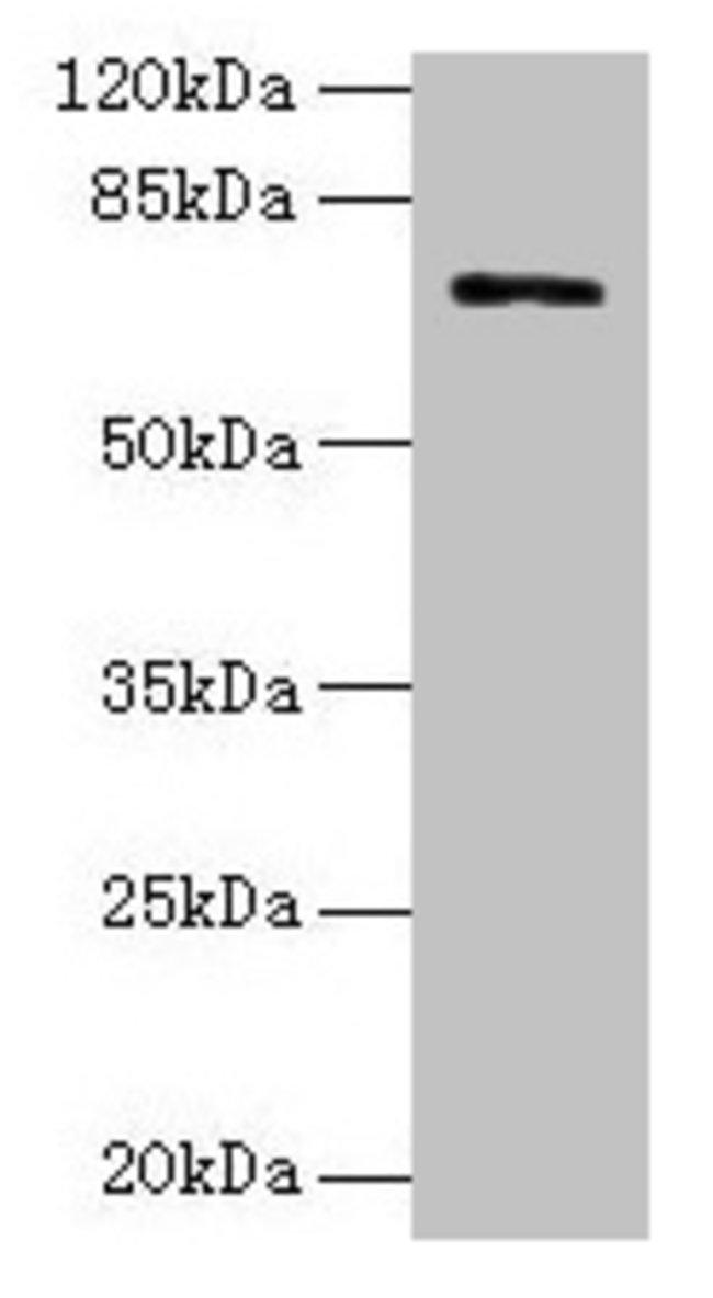 TAUT Antibody in Western Blot (WB)