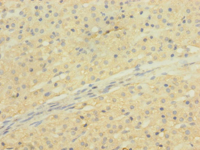 SLCO2B1 Antibody in Immunohistochemistry (Paraffin) (IHC (P))