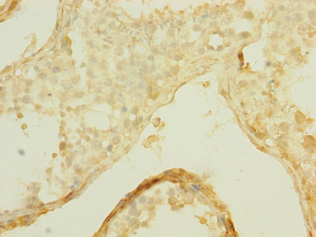 SLCO2B1 Antibody in Immunohistochemistry (Paraffin) (IHC (P))