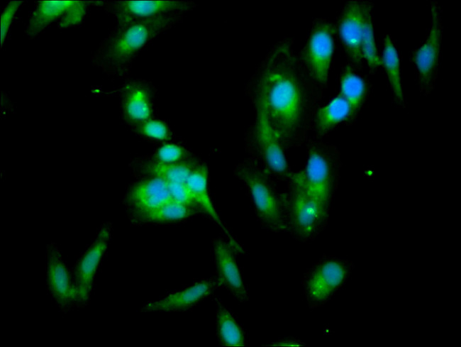 14-3-3 eta Antibody in Immunocytochemistry (ICC/IF)