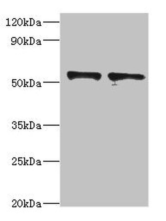 SPTLC1 Antibody in Western Blot (WB)