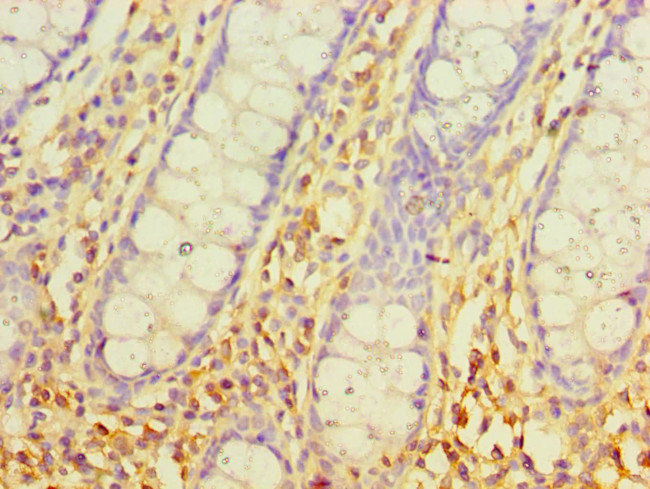 SRM Antibody in Immunohistochemistry (Paraffin) (IHC (P))