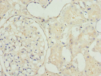 TAGLN2 Antibody in Immunohistochemistry (Paraffin) (IHC (P))