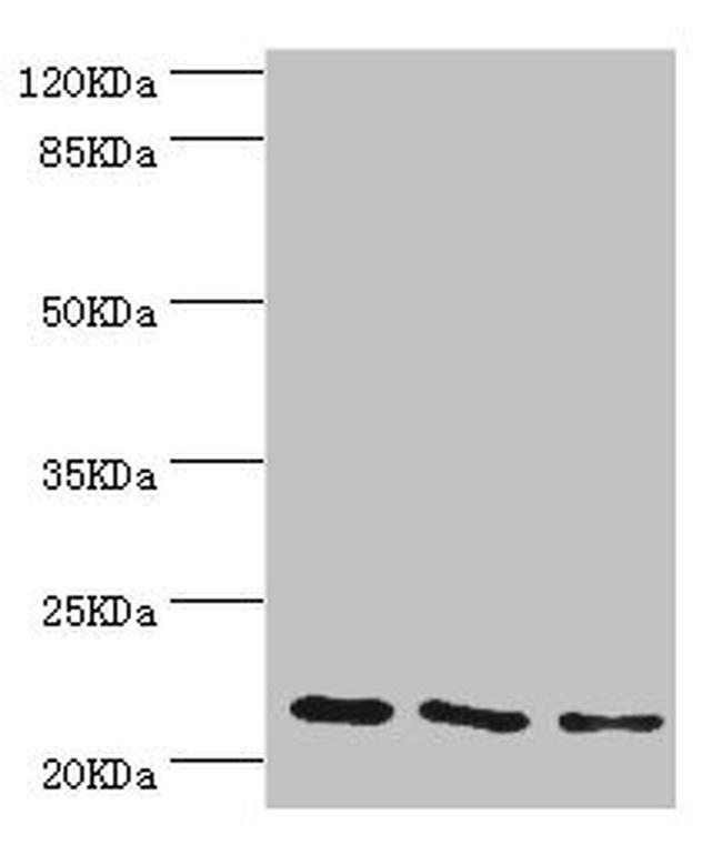 TAGLN2 Antibody in Western Blot (WB)