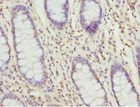 TAGLN2 Antibody in Immunohistochemistry (Paraffin) (IHC (P))