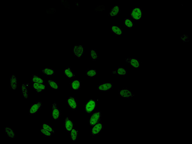 TBL1X Antibody in Immunocytochemistry (ICC/IF)