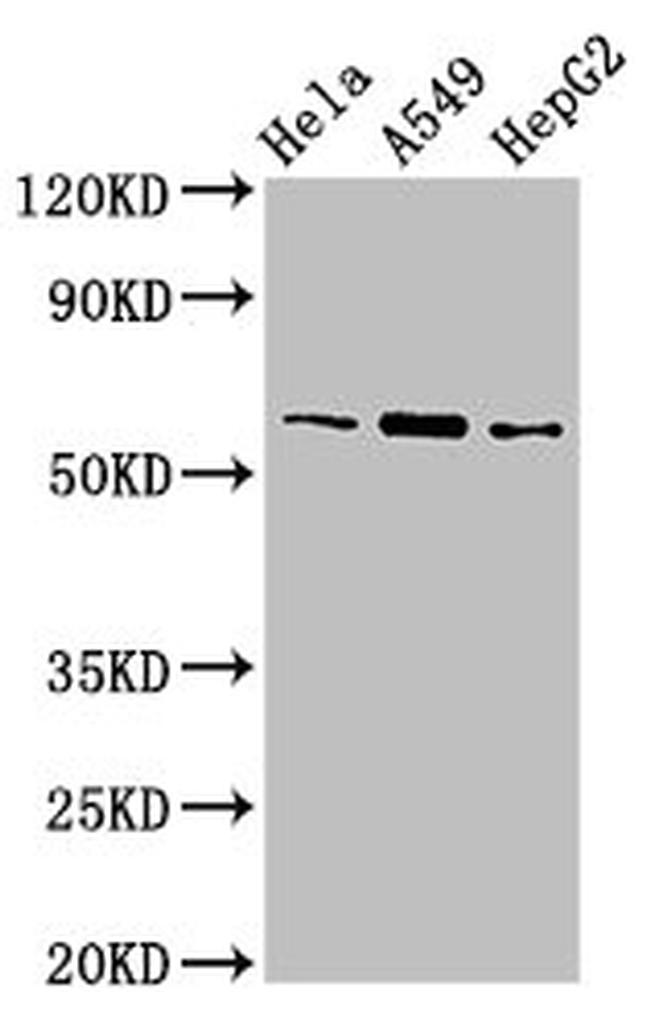 TBL1X Antibody in Western Blot (WB)