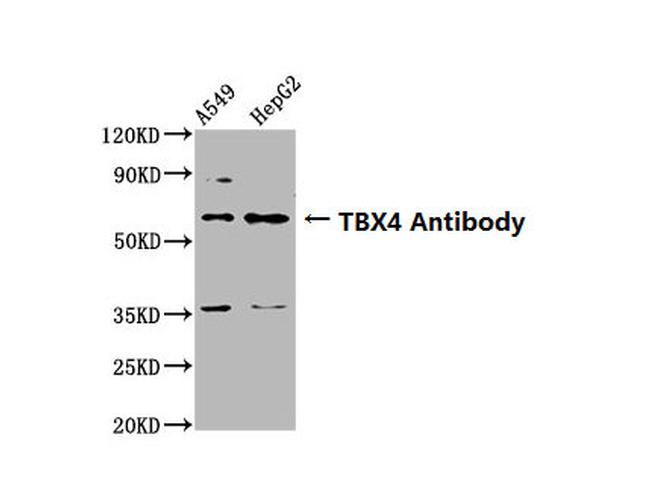 TBX4 Antibody in Western Blot (WB)