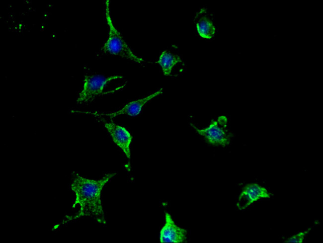 TCN2 Antibody in Immunocytochemistry (ICC/IF)