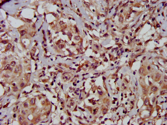 TFB1M Antibody in Immunohistochemistry (Paraffin) (IHC (P))