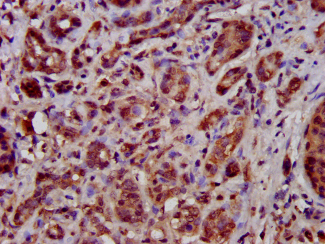 TFB1M Antibody in Immunohistochemistry (Paraffin) (IHC (P))