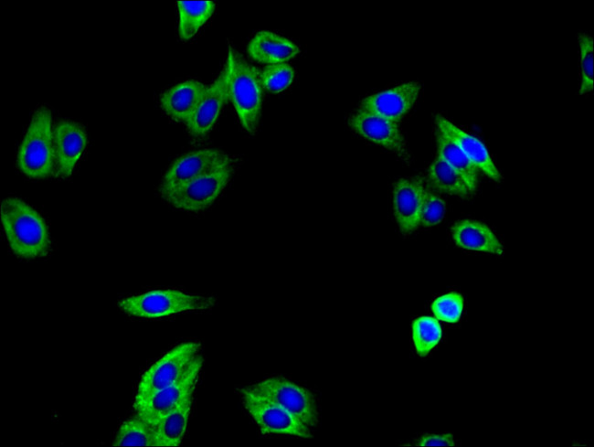 TGFBR1 Antibody in Immunocytochemistry (ICC/IF)