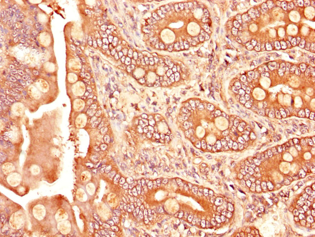 TGFBR1 Antibody in Immunohistochemistry (Paraffin) (IHC (P))