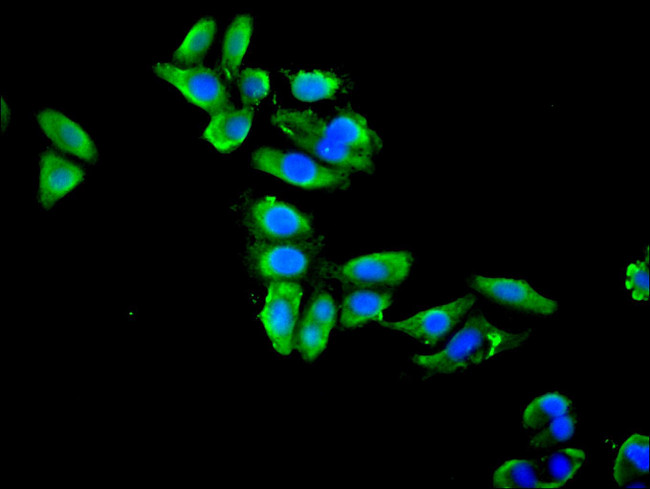 ENO1 Antibody in Immunocytochemistry (ICC/IF)