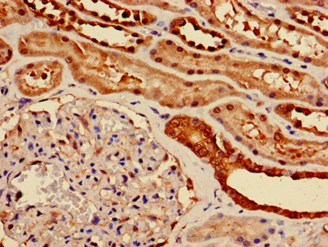 ENO1 Antibody in Immunohistochemistry (Paraffin) (IHC (P))