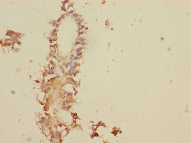 TNFAIP8 Antibody in Immunohistochemistry (Paraffin) (IHC (P))