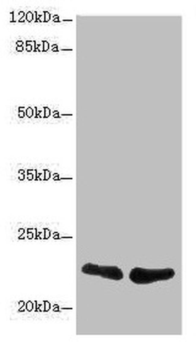 TNFAIP8 Antibody in Western Blot (WB)