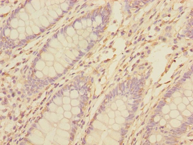 TNFAIP8 Antibody in Immunohistochemistry (Paraffin) (IHC (P))