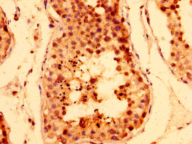 Tankyrase Antibody in Immunohistochemistry (Paraffin) (IHC (P))