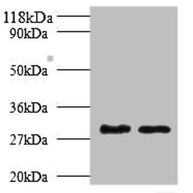 TPSB2 Antibody in Western Blot (WB)