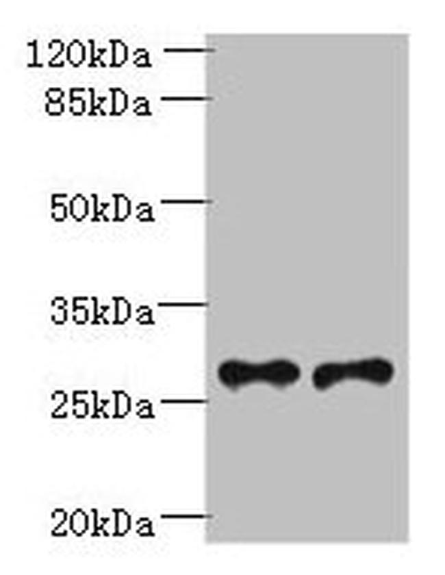 TREM2 Antibody in Western Blot (WB)