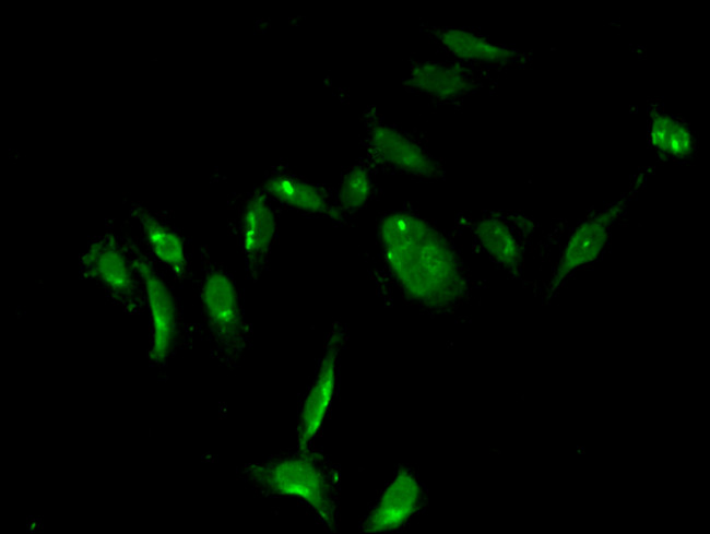 Thymidylate Synthase Antibody in Immunocytochemistry (ICC/IF)