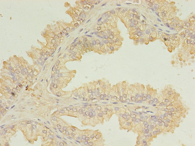 UBE2D1 Antibody in Immunohistochemistry (Paraffin) (IHC (P))