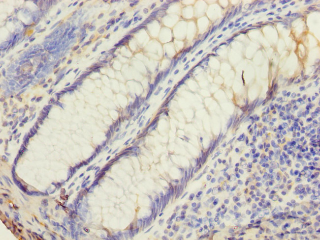 UBE2G2 Antibody in Immunohistochemistry (Paraffin) (IHC (P))