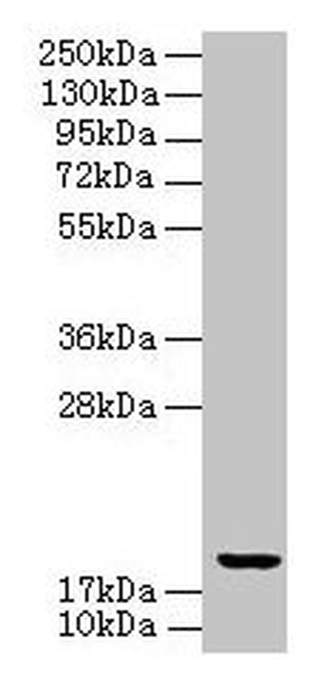 UBE2G2 Antibody in Western Blot (WB)