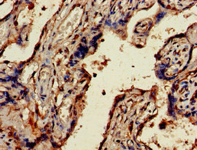 UBE2V2 Antibody in Immunohistochemistry (Paraffin) (IHC (P))