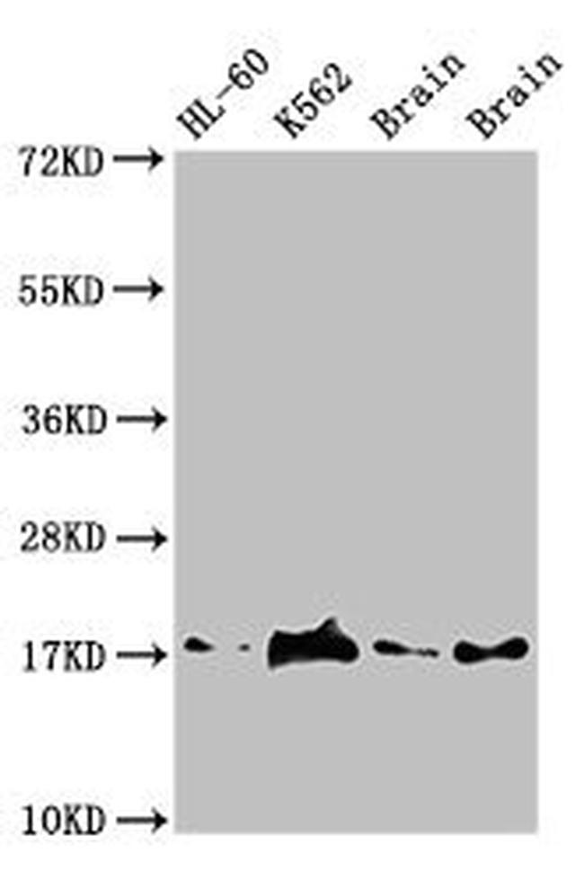 UBE2V2 Antibody in Western Blot (WB)