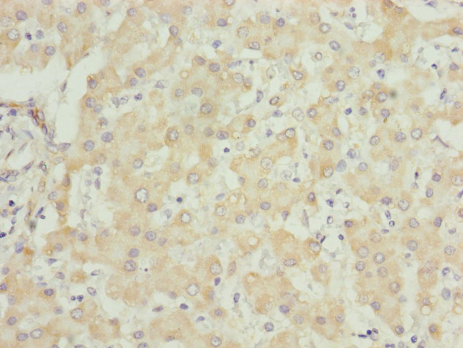 UQCRC1 Antibody in Immunohistochemistry (Paraffin) (IHC (P))