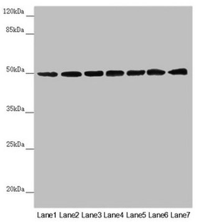 UQCRC1 Antibody in Western Blot (WB)