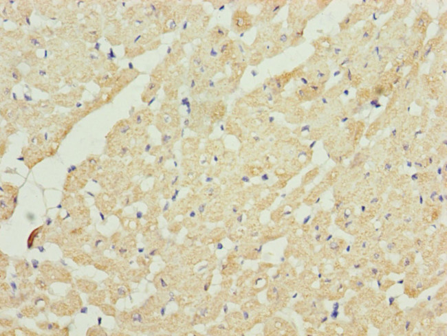 UQCRC2 Antibody in Immunohistochemistry (Paraffin) (IHC (P))