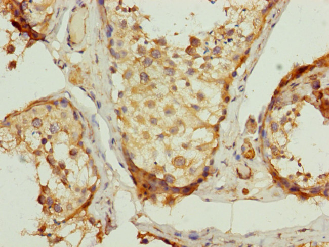 UQCRC2 Antibody in Immunohistochemistry (Paraffin) (IHC (P))