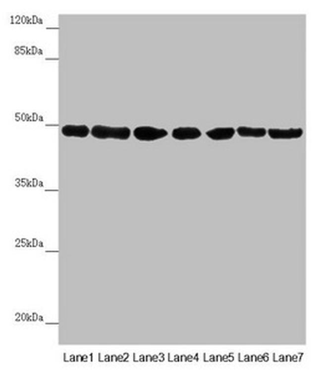 UQCRC2 Antibody in Western Blot (WB)