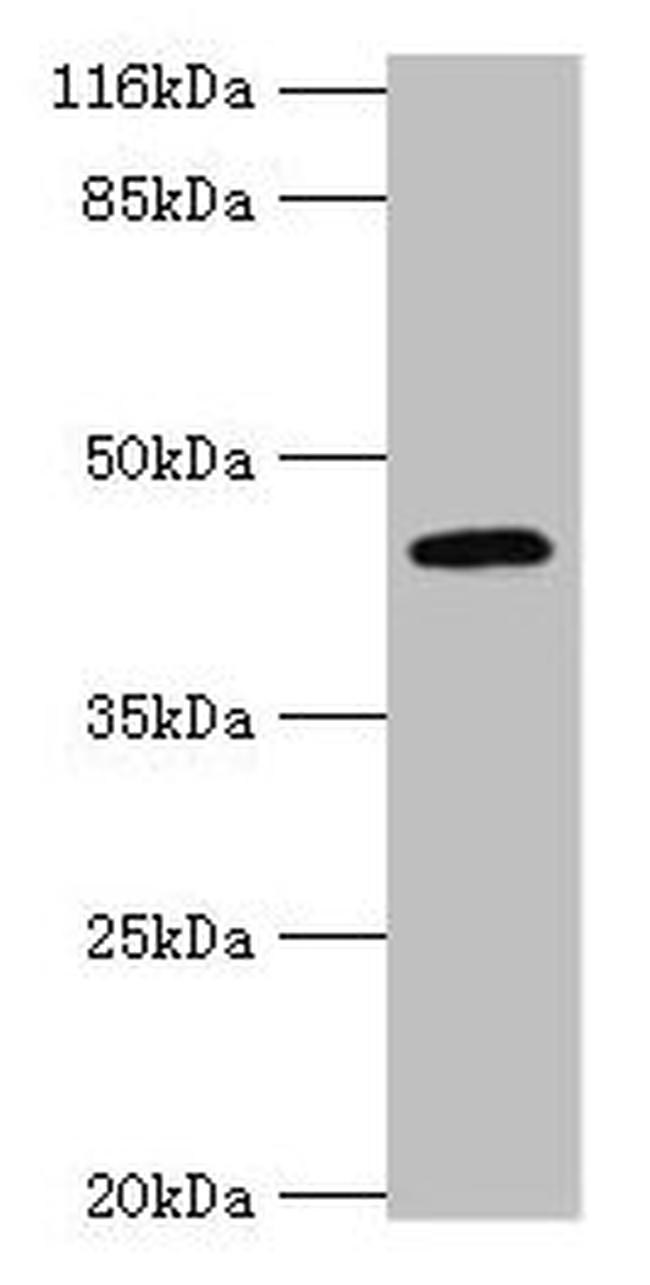 USP12 Antibody in Western Blot (WB)