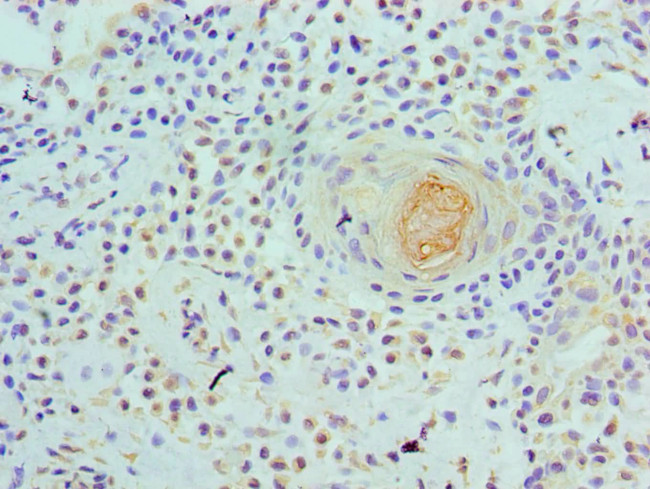 WDR5 Antibody in Immunohistochemistry (Paraffin) (IHC (P))