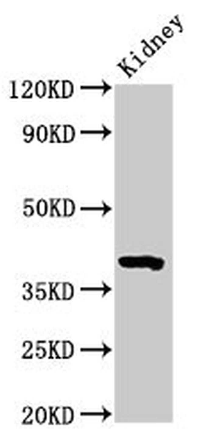 WNT3 Antibody in Western Blot (WB)